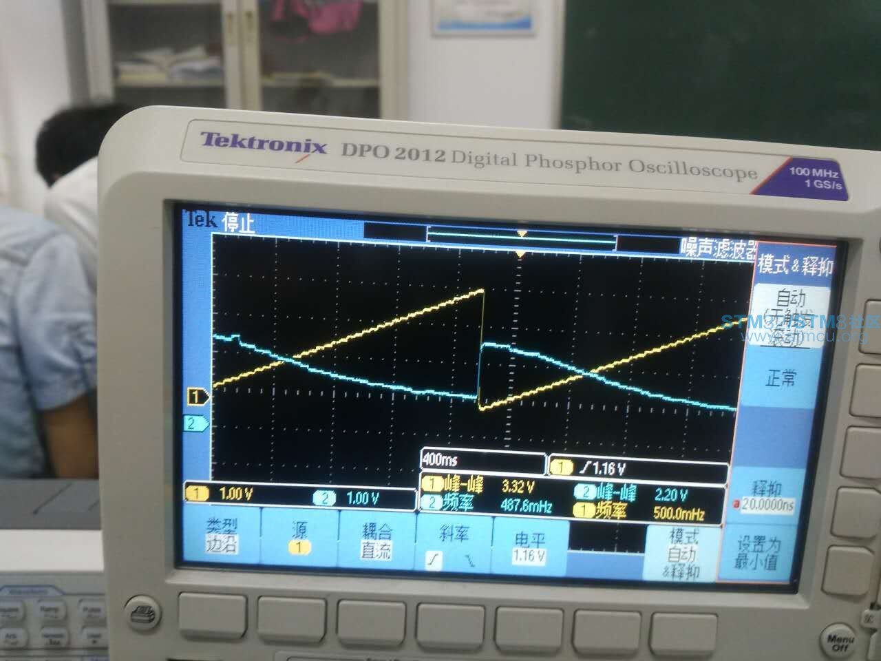 trigåæ­¥